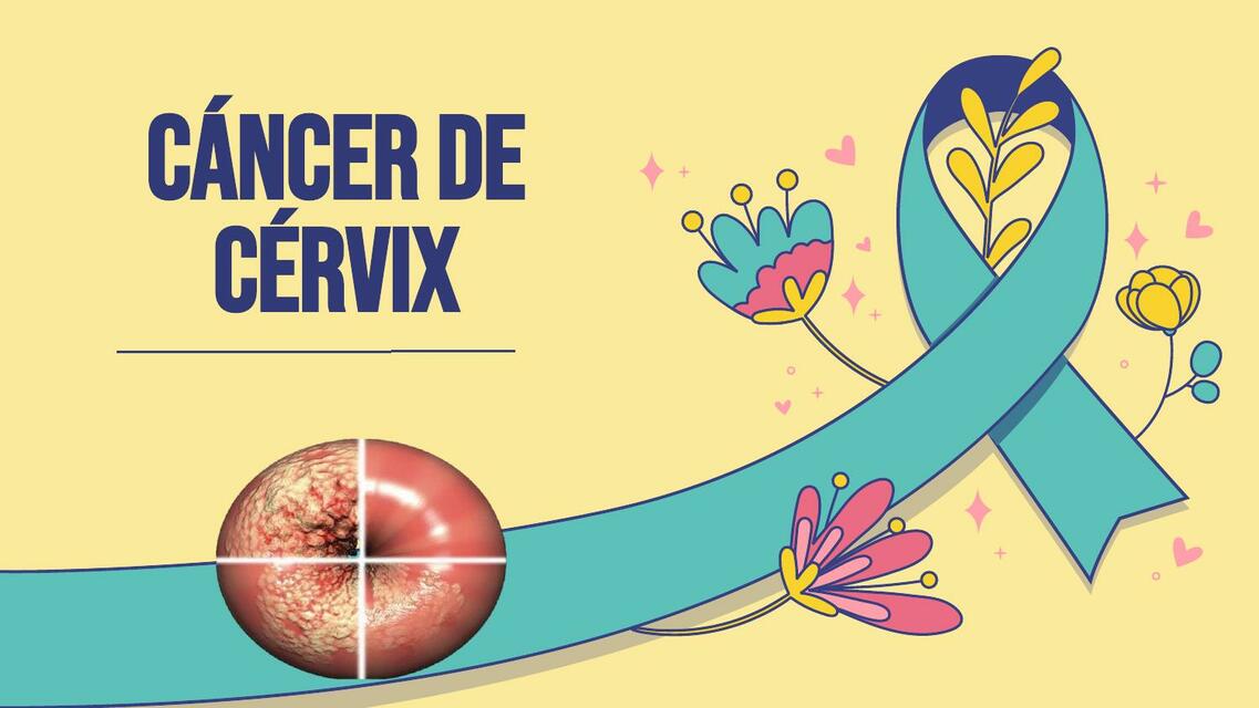 Cáncer de Cérvix