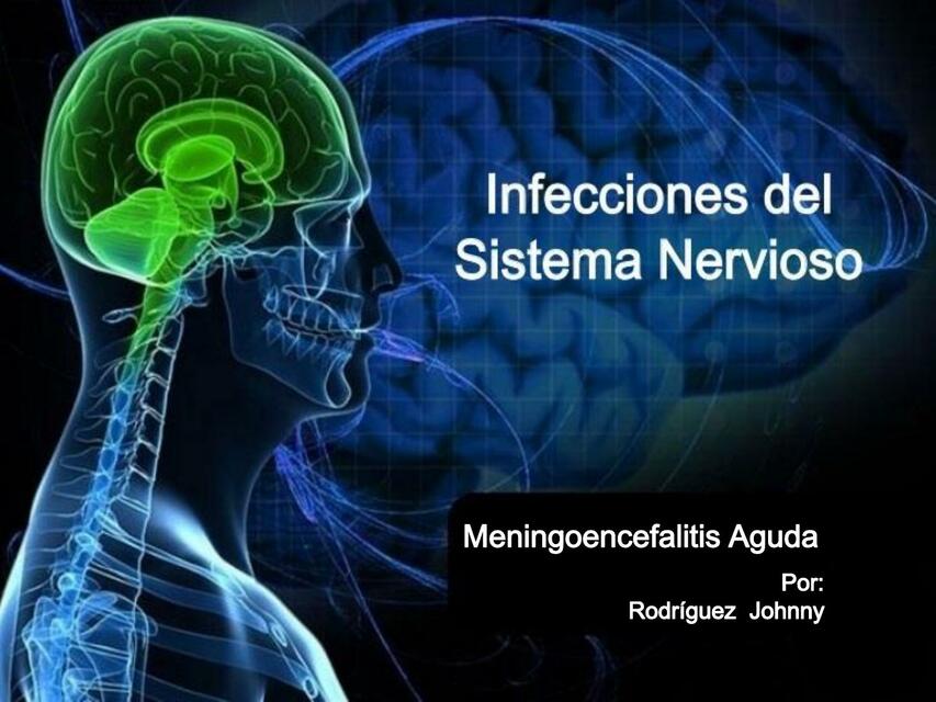 Infecciones del Sistema Nervioso