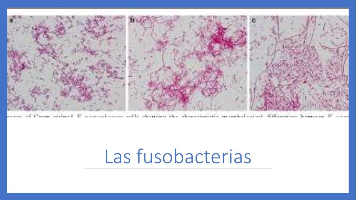 Las fusobacterias