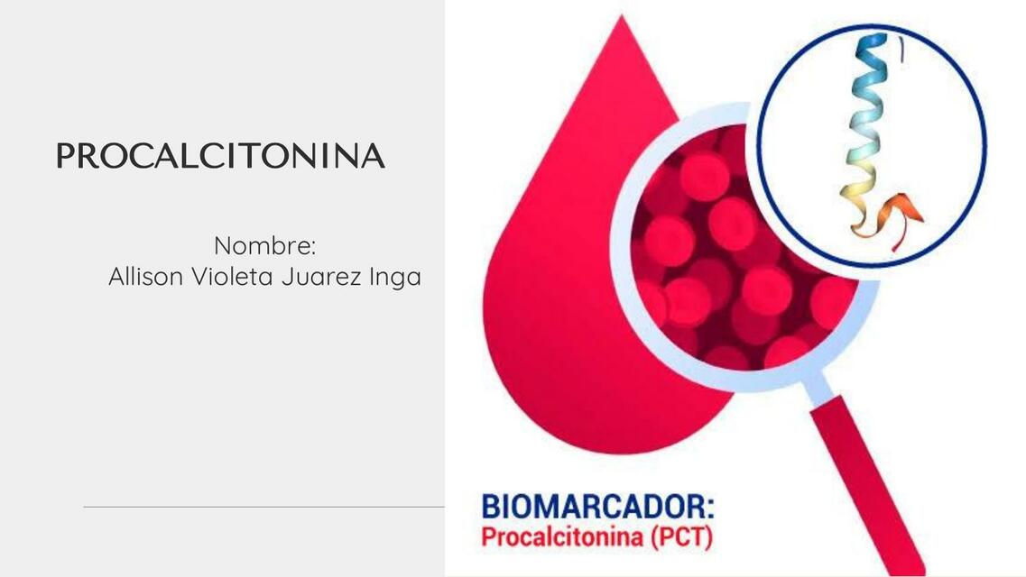 Procalcitonina Usada en Sepsis