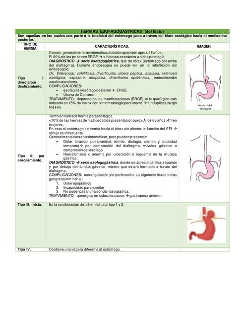 Hernias