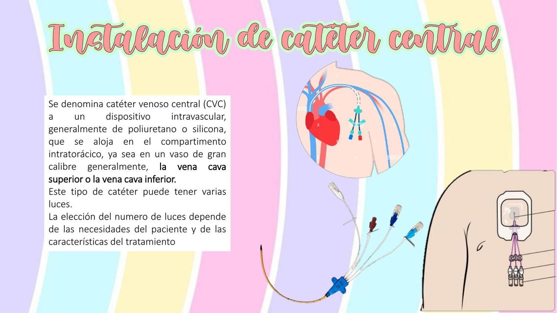 Cat Ter Venoso Central Intubaci N Endotraqueal Y Sedantes Tratamiento Para Tce Mundo D