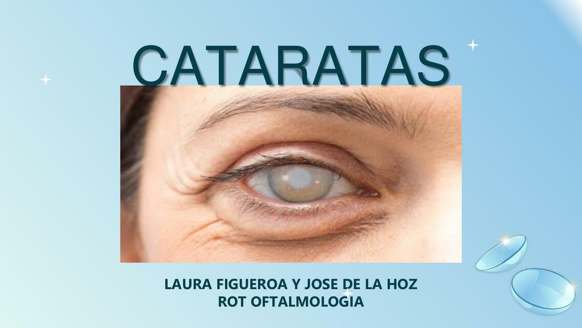 Cataratas 