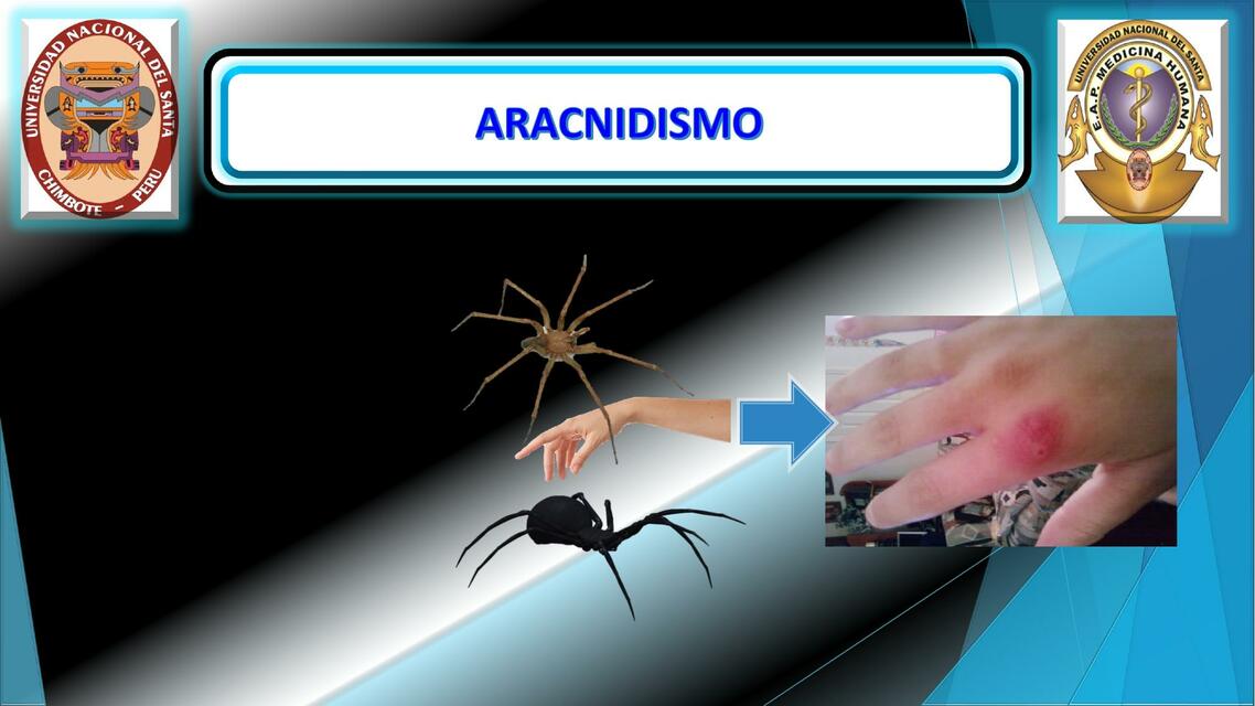 Aracnidismo 