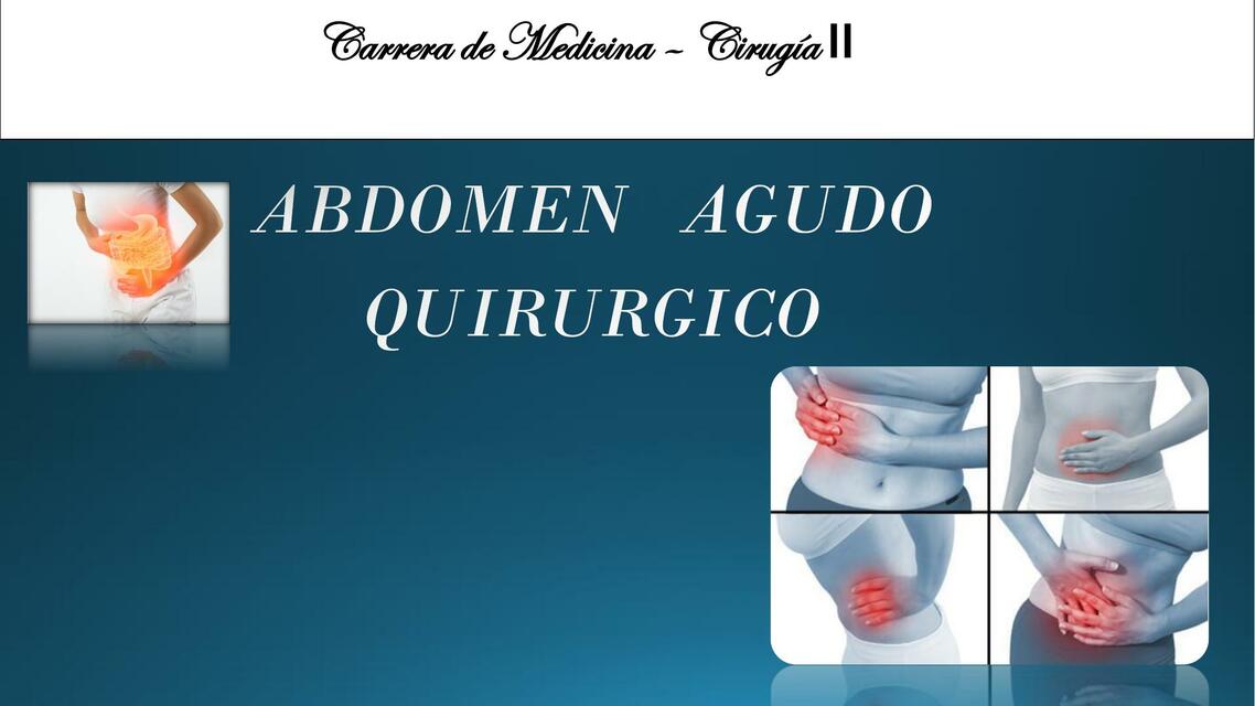 Abdomen Agudo Quirúrgico 