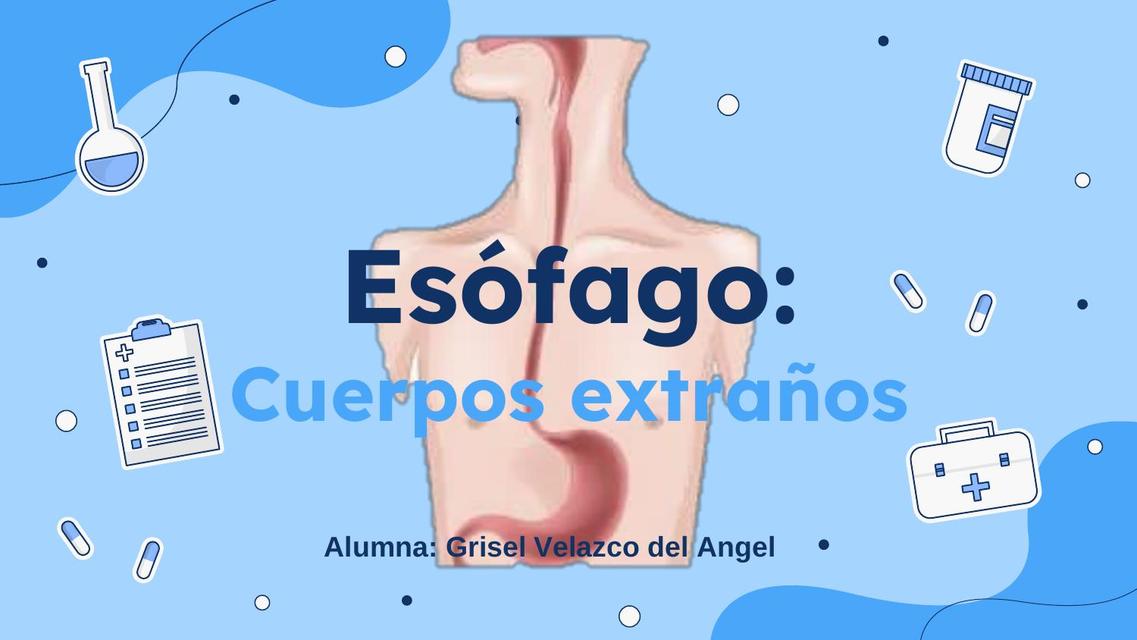 Esófago  Tumores y cuerpos extraños 