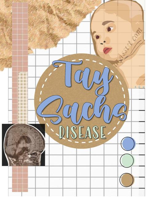 Tay Sachs disease 