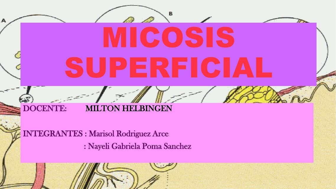 Micosis Superficial