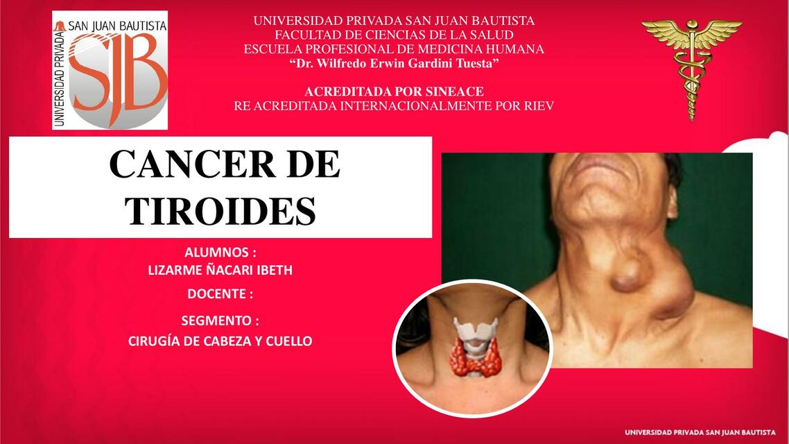 Cáncer de Tiroides 