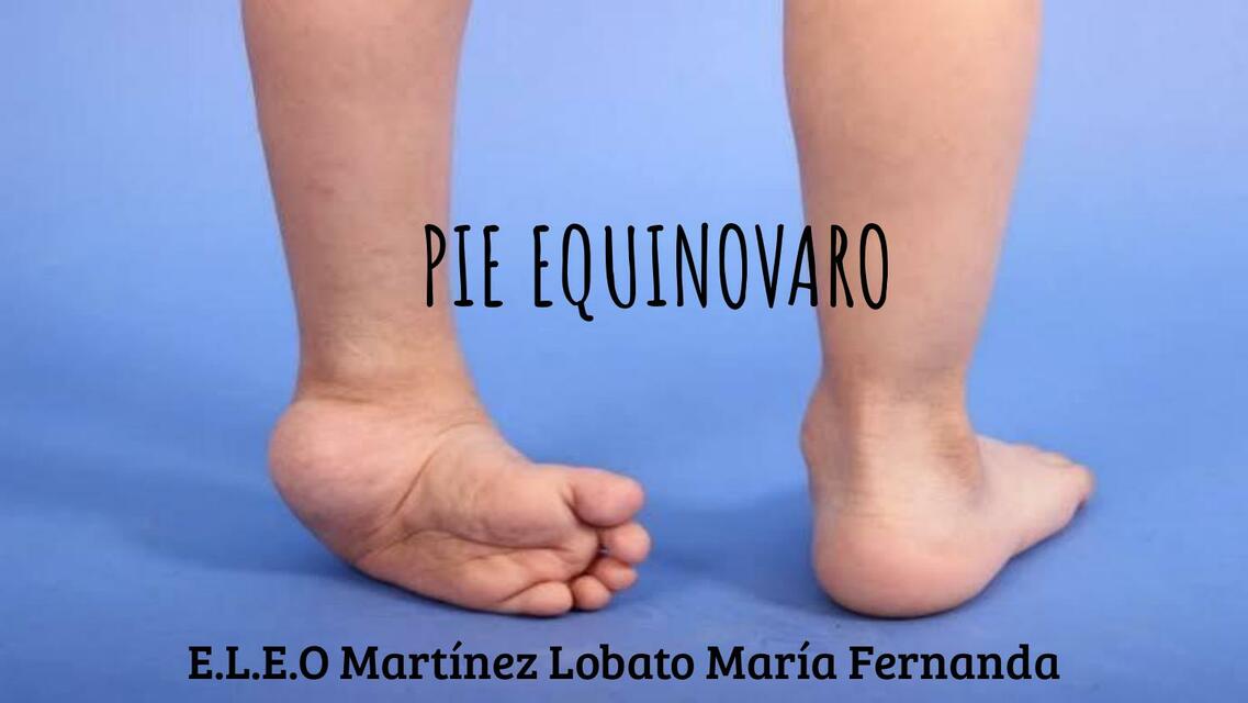 Pie equinobaro MARIA MARTINEZ uDocz