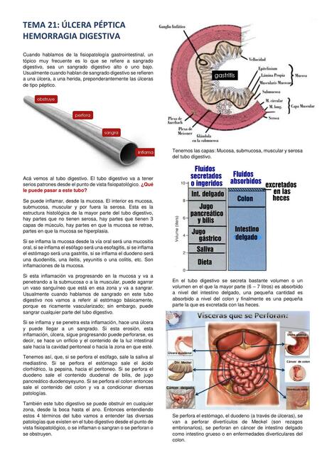 Úlcera Péptica Hemorragia Digestiva