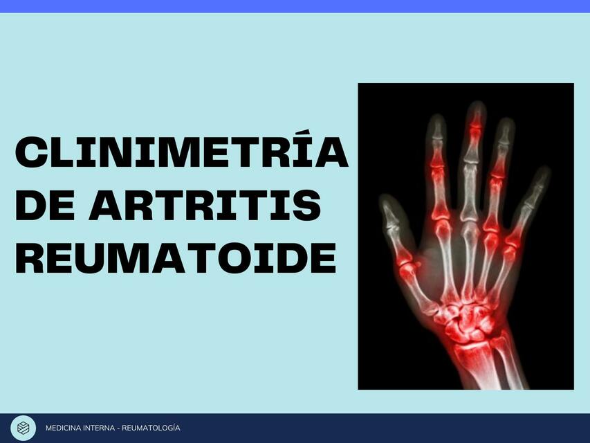 Clinimetría de Artritis Reumatoide