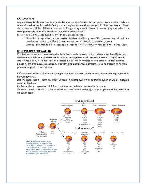 Leucemia Linfocítica Aguda 