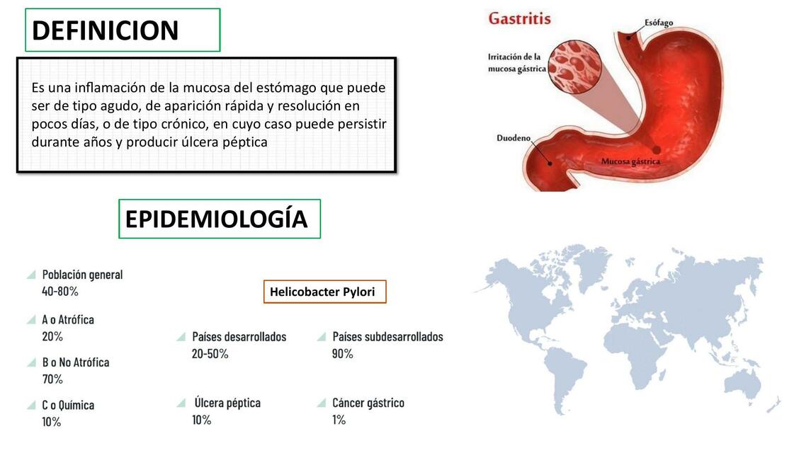 Gastritis aguda