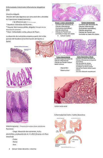 Enfermedad de Crohn y Colitis Ulcerativa