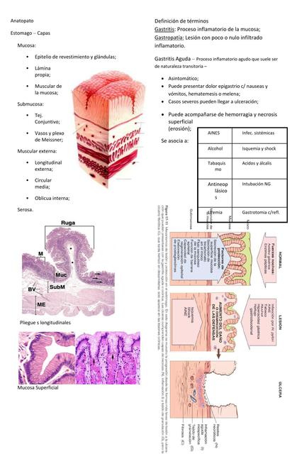 Gastritis