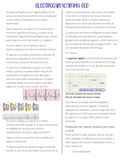 electrocardiograma