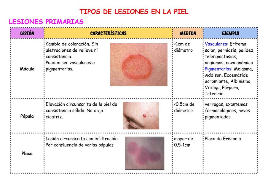 lesiones-piel-odeth-calderon-udocz