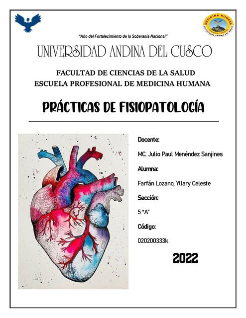 Insuficiencia Cardiaca Izquierda y Derecha 