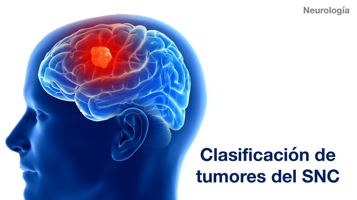 Clasificación de los Tumores del SNC