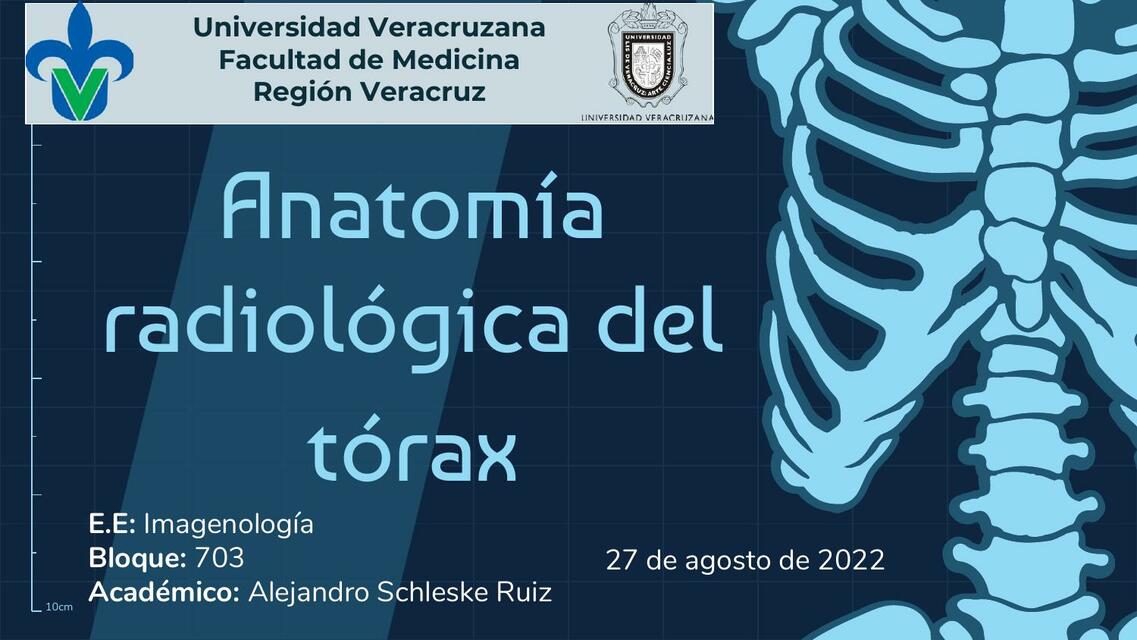 Anatomía Radiológica del Tórax