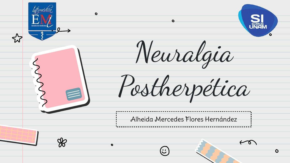 Neuralgia Postherpética -Algología