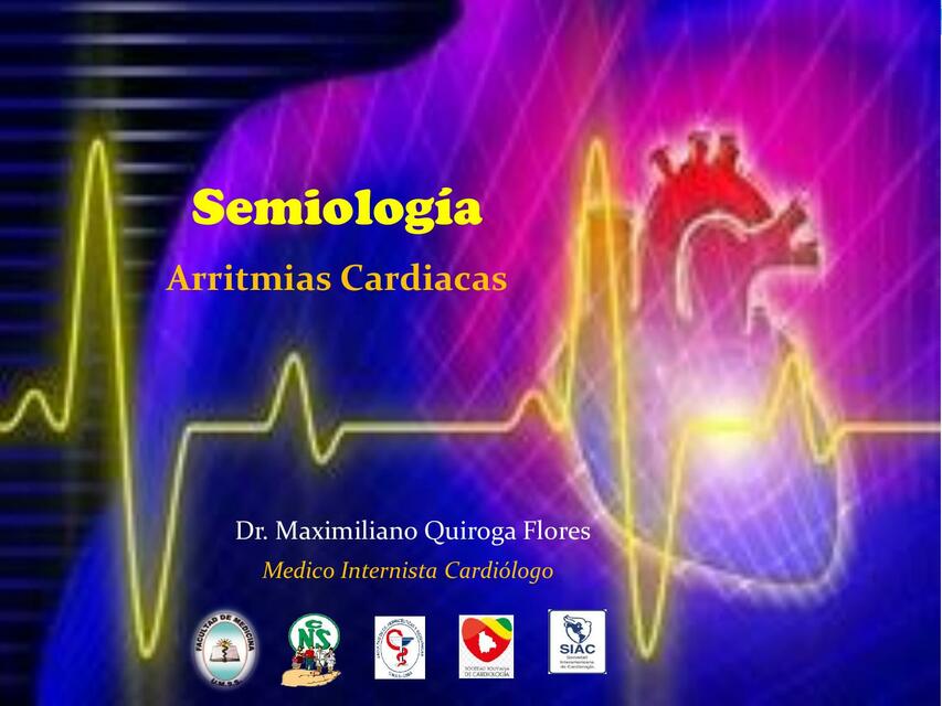 Arritmias Cardiacas