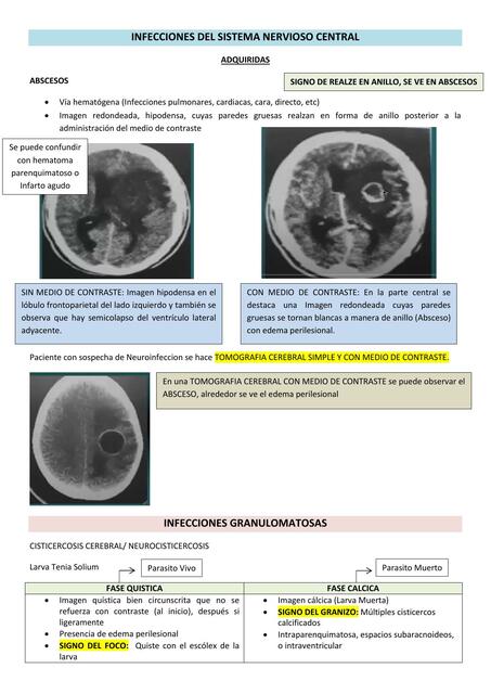 Infecciones del SNC