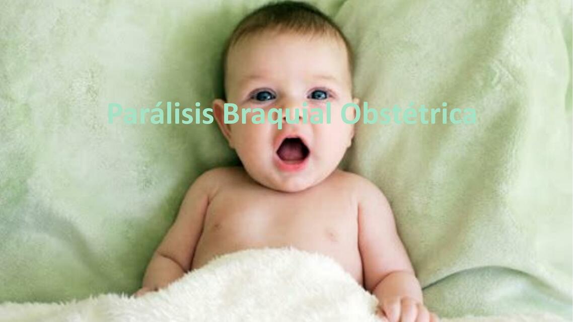 Parálisis Braquial Obstétrica 