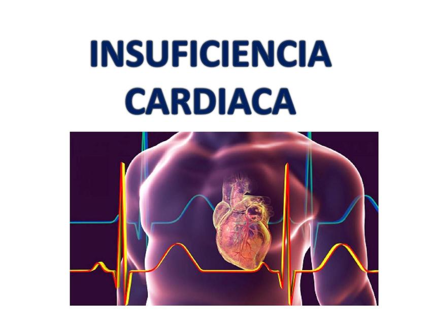 INSUFICIENCIA CARDIACA