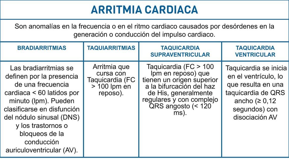 Arritmia cardiaca