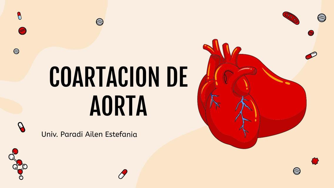 COARTACION DE AORTA