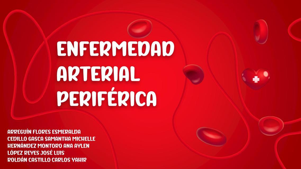 Enfermedad arterial periférica