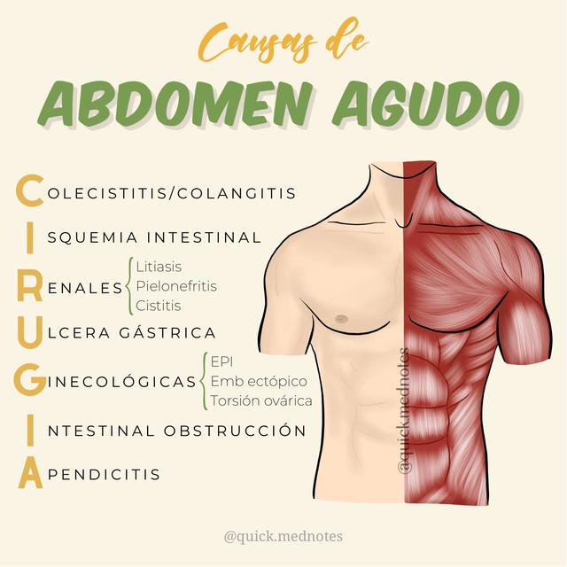 Abdomen Agudo