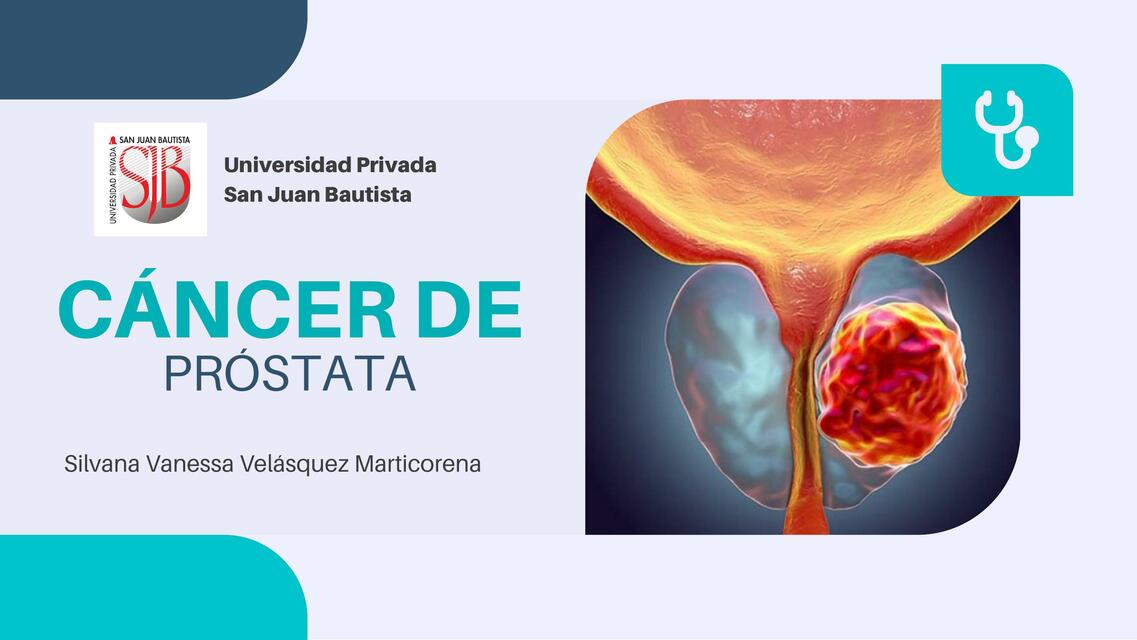 Cáncer de Próstata 