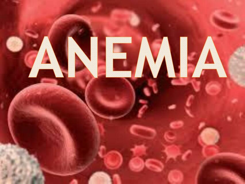 Anemia