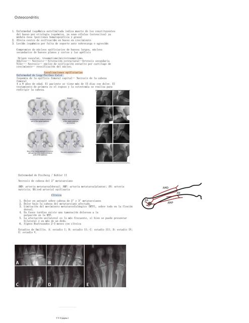 Osteocondritis