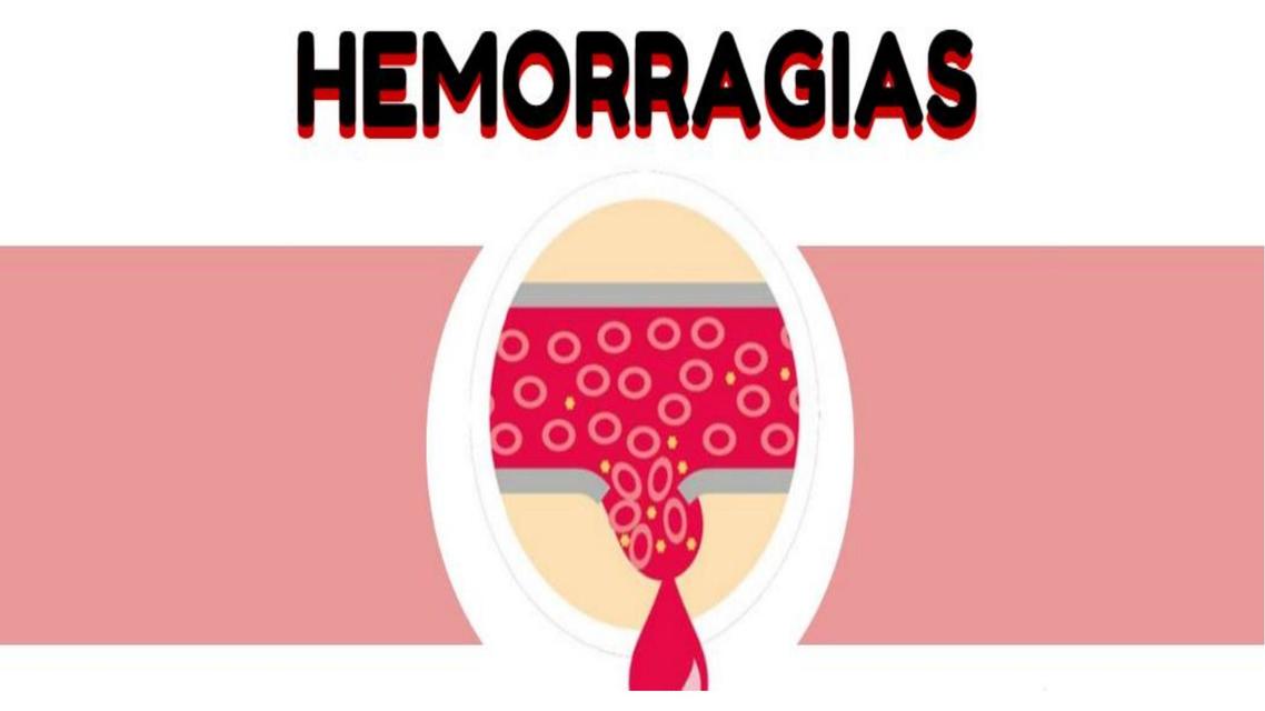 Hemorragias 