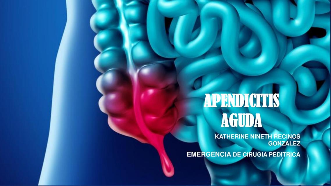 APENDICITIS AGUDA Autoguardado