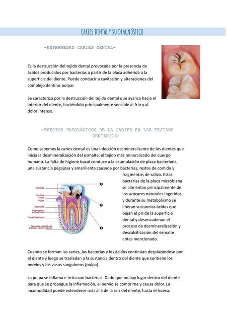 Caries dental y su diagnóstico 