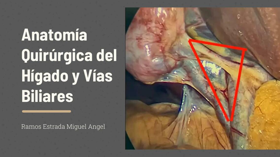 Anatomía Quirúrgica de Hígado y Vías Biliares