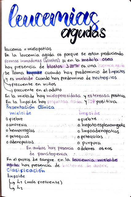 Leucemias agudas