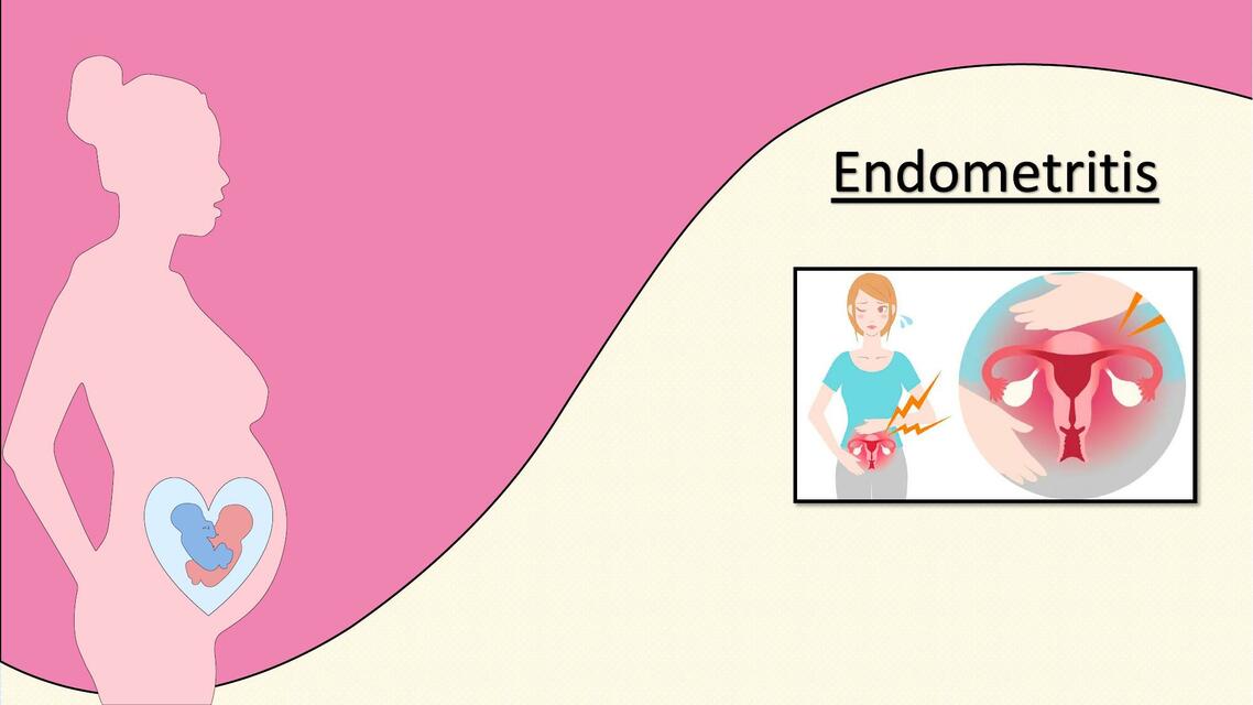 Endometriosis 