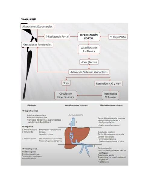 Cirrosis 