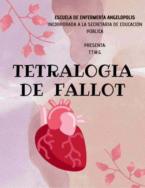 Tetralogía de Fallot 