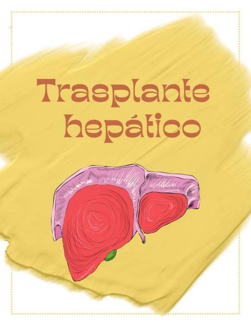 trasplante de higado