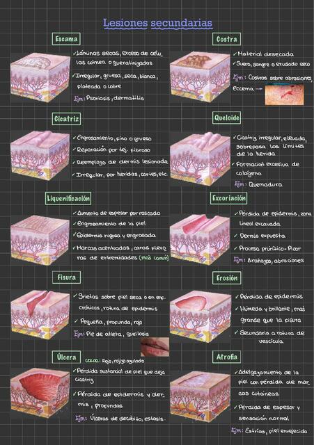 Lesiones secundarias