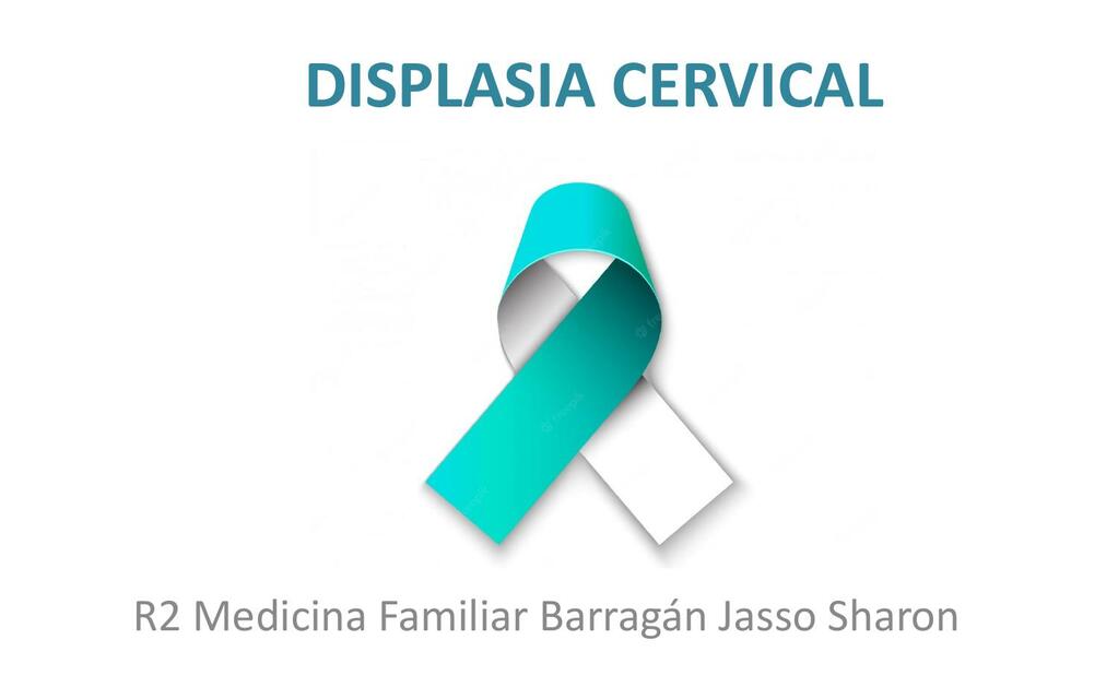 Displasia Cervical