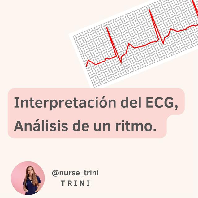 Interpretaciones ECG