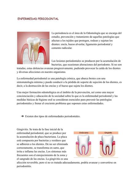 Enfermedad Periodontal 